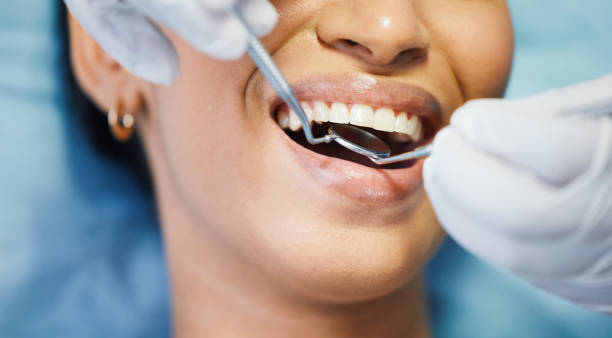 Best Broken Tooth Emergency  in Clarcona, FL
